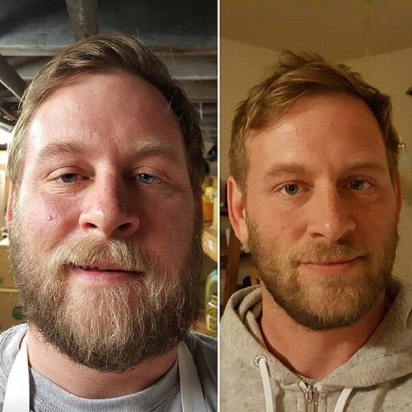la apariencia de la persona antes y después de dejar el alcohol